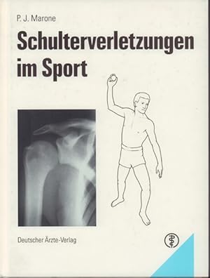 Schulterverletzungen im Sport