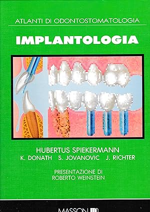 Atlanti di Odontostomatologia. Implantologia