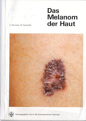 Seller image for Das Melanom der Haut. for sale by Versandantiquariat Sylvia Laue