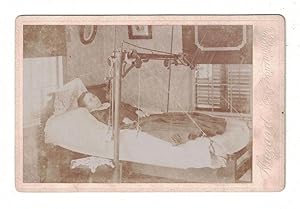 Image du vendeur pour [MEDICAL DEFORMITIES] [PHOTOGRAPHY] [MEDICAL EQUIPMENT] Cabinet card depicting a woman with deformed limbs in her bed with a large mobility device mis en vente par Cleveland Book Company, ABAA