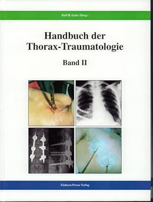 Handbuch der Thorax-Traumatologie Band 2
