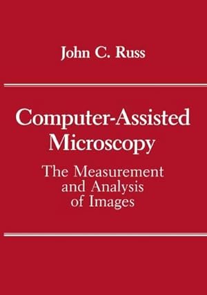 Bild des Verkufers fr Computer-Assisted Microscopy : The Measurement and Analysis of Images zum Verkauf von AHA-BUCH GmbH