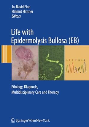 Immagine del venditore per Life with Epidermolysis Bullosa (EB) : Etiology, Diagnosis, Multidisciplinary Care and Therapy venduto da AHA-BUCH GmbH