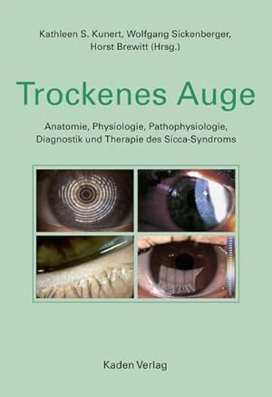 Seller image for Trockenes Auge : Anatomie, Physiologie, Pathophysiologie, Diagnostik und Therapie des Sicca-Syndroms for sale by AHA-BUCH GmbH