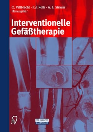 Bild des Verkufers fr Interventionelle Geftherapie zum Verkauf von AHA-BUCH GmbH