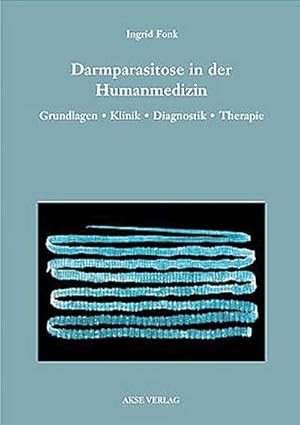 Image du vendeur pour Darmparasitose in der Humanmedizin : Grundlagen, Klinik, Diagnostik, Therapie mis en vente par AHA-BUCH GmbH