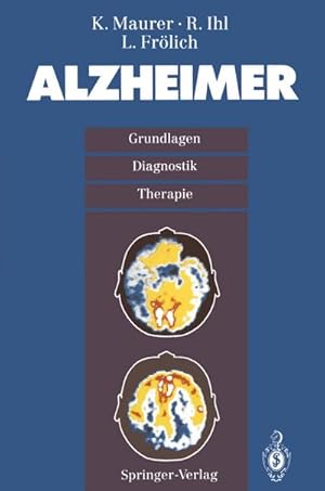 Bild des Verkufers fr Alzheimer : Grundlagen, Diganostik, Therapie zum Verkauf von AHA-BUCH GmbH