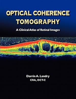 Seller image for Optical Coherence Tomography a Clinical Atlas of Retinal Images for sale by GreatBookPrices