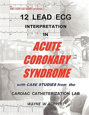 Bild des Verkufers fr 12 Lead ECG Interpretation in Acute Coronary Syndrome with Case Studies from the Cardiac Catheterization Lab zum Verkauf von GreatBookPrices