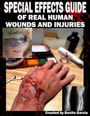 Bild des Verkufers fr Special Effects Guide of Real Human Wounds and Injuries : Special Effects Guide of Real Human Wounds and Injuries zum Verkauf von GreatBookPrices