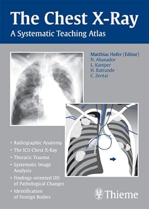 Imagen del vendedor de Chest X-Ray : A Systematic Teaching Atlas a la venta por GreatBookPrices