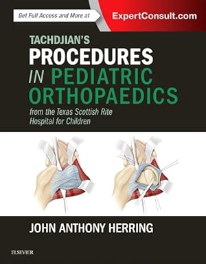 Seller image for Tachdjian's Procedures in Pediatric Orthopaedics : From the Texas Scottish Rite Hospital for Children for sale by GreatBookPrices