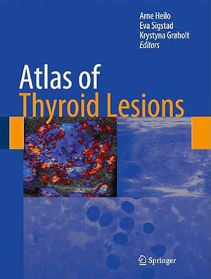 Immagine del venditore per Atlas of Thyroid Lesions venduto da GreatBookPrices