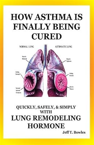 Seller image for How Asthma Is Finally Being Cured : Quickly, Safely, & Simply With Lung-remodeling Hormone for sale by GreatBookPrices