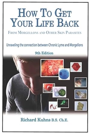 Seller image for How to Get Your Life Back from Morgellons and Other Skin Parasites for sale by GreatBookPrices