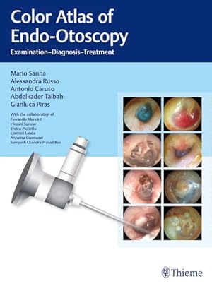 Image du vendeur pour Color Atlas of Endo-Otoscopy : Examination-Diagnosis-Treatment mis en vente par GreatBookPrices