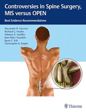 Imagen del vendedor de Controversies in Spine Surgery, Mis Versus Open : Best Evidence Recommendations a la venta por GreatBookPrices