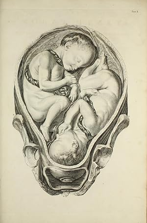 A Sett of Anatomical Tables, with Explanation and an Abridgement of the Practice of Midwifery, wi...