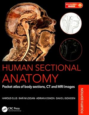 Immagine del venditore per Human Sectional Anatomy : Pocket Atlas of Body Sections, CT and MRI Images venduto da GreatBookPrices
