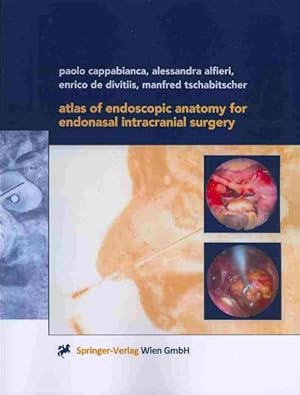 Seller image for Atlas of Endoscopic Anatomy for Endonasal Intracranial Surgery for sale by GreatBookPrices