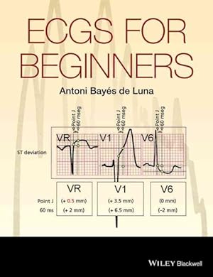 Seller image for ECGs for Beginners for sale by GreatBookPrices