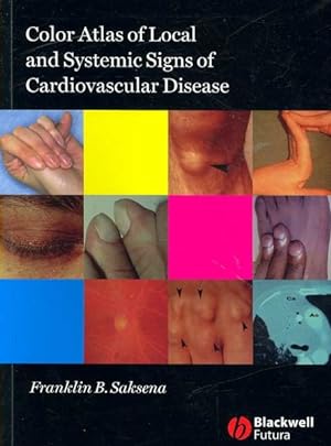 Seller image for Color Atlas of Local and Systemic Signs of Cardiovascular Disease for sale by GreatBookPrices