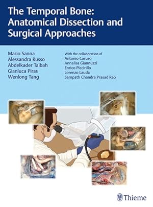 Bild des Verkufers fr Temporal Bone : Anatomical Dissection and Surgical Approaches zum Verkauf von GreatBookPrices