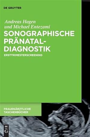 Imagen del vendedor de Sonographische Prnataldiagnostik : Ersttrimesterscreening -Language: german a la venta por GreatBookPrices