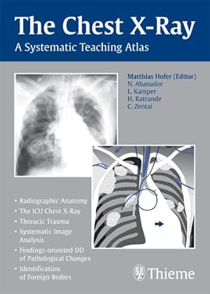 Immagine del venditore per Chest X-Ray : A Systematic Teaching Atlas venduto da GreatBookPrices