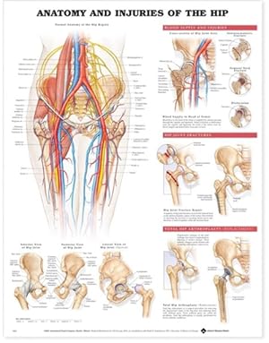 Imagen del vendedor de Anatomy & Injuries of the Hip Anatomical Chart a la venta por GreatBookPrices