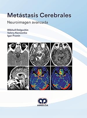 Imagen del vendedor de Metstasis Cerebrales. Neuroimagen Avanzada a la venta por Vuestros Libros