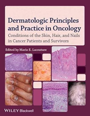 Seller image for Dermatologic Principles and Practice in Oncology : Conditions of the Skin, Hair, and Nails in Cancer Patients for sale by GreatBookPrices