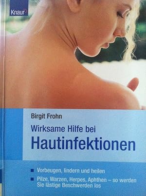 Imagen del vendedor de Wirksame Hilfe bei Hautinfektionen : vorbeugen, lindern, heilen ; Pilze, Warzen, Herpes, Aphthen, so werden Sie lstige Beschwerden los a la venta por Versandantiquariat Jena