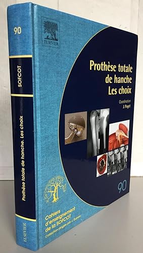 Prothèse totale de hanche : Les choix