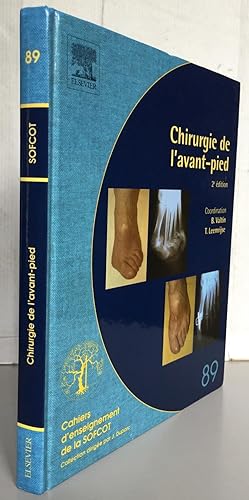 Image du vendeur pour Chirurgie de l'Avant-pied N89 : 2E EDITION mis en vente par Librairie Thot