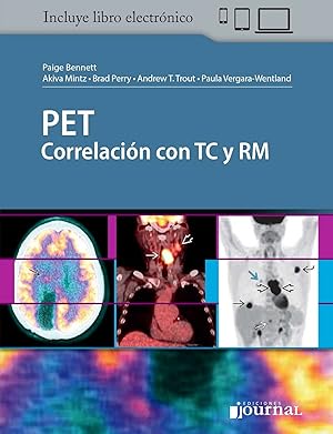 Seller image for PET Correlacin con TC y RM + ebook for sale by Vuestros Libros