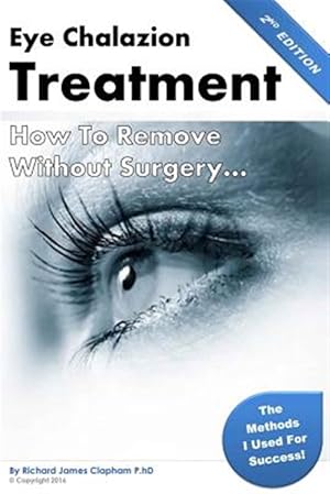 Image du vendeur pour Eye Chalazion : How to Remove Without Surgery mis en vente par GreatBookPrices