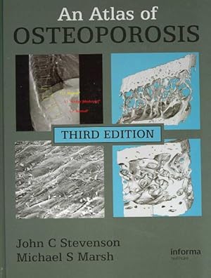 Seller image for Atlas of Osteoporosis for sale by GreatBookPrices