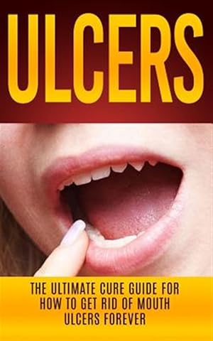 Bild des Verkufers fr Ulcers : The Ultimate Cure Guide for How to Get Rid of Mouth Ulcers Instantly zum Verkauf von GreatBookPrices