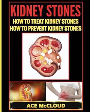 Imagen del vendedor de Kidney Stones : How to Treat Kidney Stones: How to Prevent Kidney Stones a la venta por GreatBookPrices