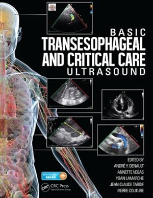 Bild des Verkufers fr Basic Transesophageal and Critical Care Ultrasound zum Verkauf von GreatBookPrices