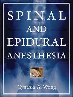 Immagine del venditore per Spinal And Epidural Anesthesia venduto da GreatBookPrices