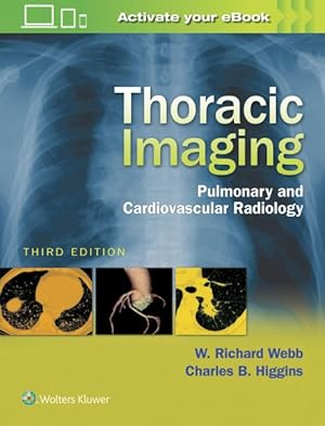 Image du vendeur pour Thoracic Imaging : Pulmonary and Cardiovascular Radiology mis en vente par GreatBookPrices