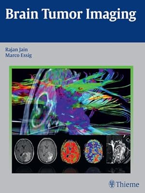 Immagine del venditore per Brain Tumor Imaging venduto da GreatBookPrices