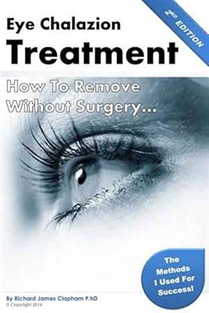 Seller image for Eye Chalazion : How to Remove Without Surgery for sale by GreatBookPrices
