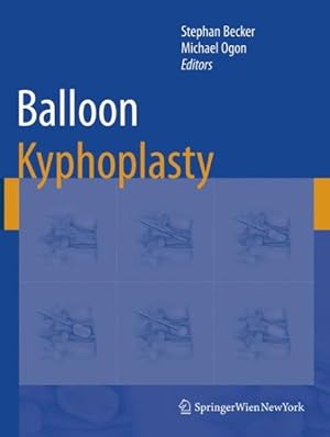 Imagen del vendedor de Balloon Kyphoplasty a la venta por GreatBookPrices