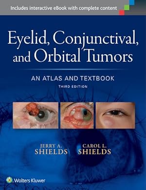 Imagen del vendedor de Eyelid, Conjunctival, and Orbital Tumors : An Atlas and Textbook a la venta por GreatBookPrices