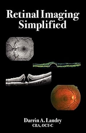 Seller image for Retinal Imaging Simplified for sale by GreatBookPrices