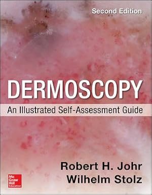 Imagen del vendedor de Dermoscopy : An Illustrated Self-Assessment Guide a la venta por GreatBookPrices