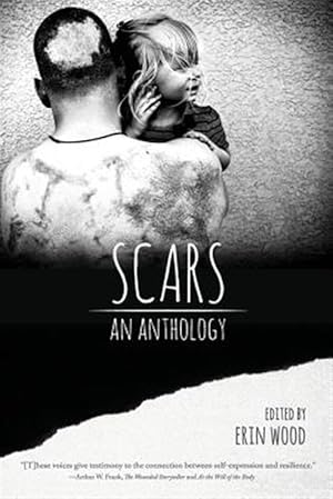 Seller image for Scars: An Anthology for sale by GreatBookPrices